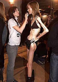Celebs With Anorexia